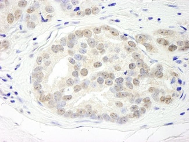 DHX15 Antibody 0.1mL; Unlabeled:Antibodies, Polyclonal | Fisher Scientific